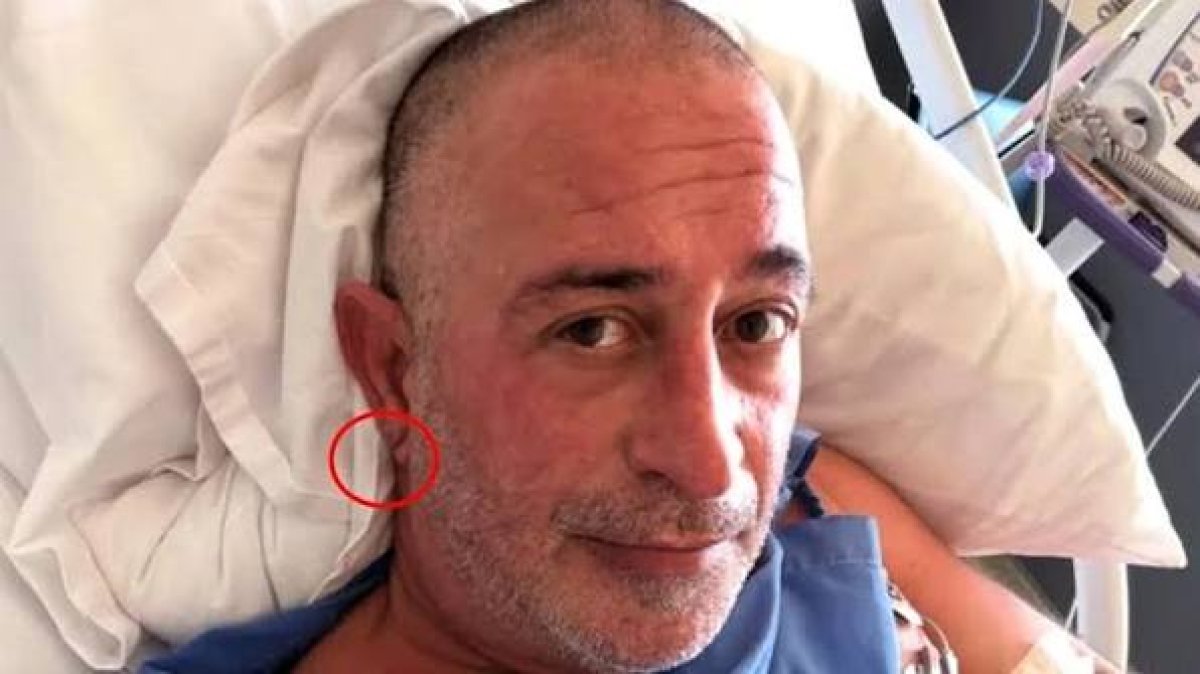 Cem Yılmaz'ın Kalp Krizi Sonrası Frank İşareti Yeniden Gündeme Geldi