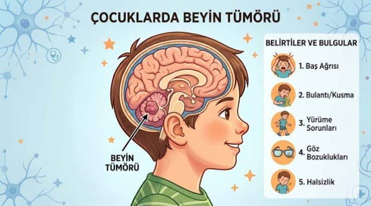 Çocukluk Çağı Beyin Tümörü: Devrim Niteliğinde T Hücre Tedavisi 