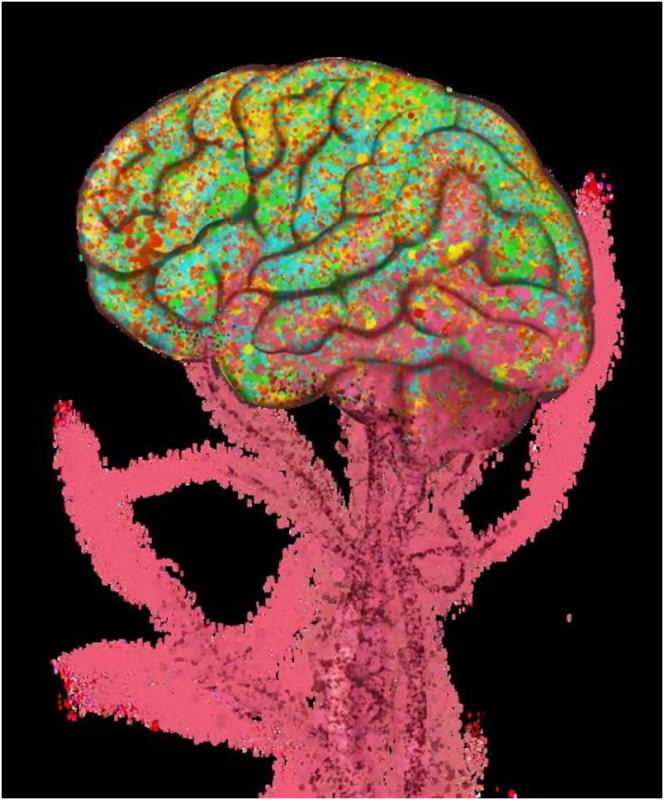 Alzheimer Hastalığında Kemik İliği Hasarının Rolü