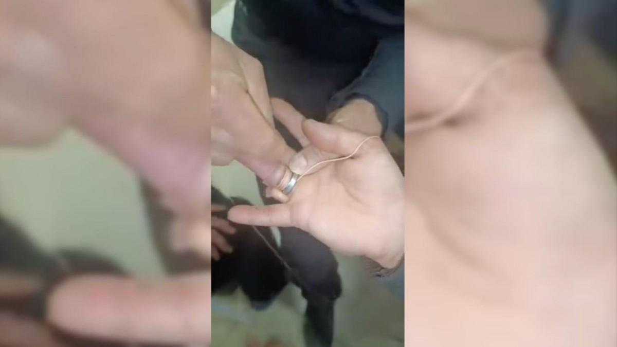 Adıyaman’da vatandaşın parmağına sıkışan yüzük çıkarıldı  - Videolu Haber